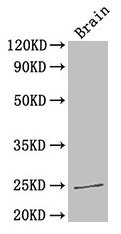 Western Blot
Positive WB detected in: Mouse brain tissue
All lanes: HMGB1 antibody at 3.3µg/ml
Secondary
Goat polyclonal to rabbit IgG at 1/50000 dilution
Predicted band size: 25 kDa
Observed band size: 25 kDa