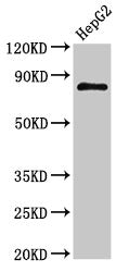 Western Blot
Positive WB detected in: HepG2 whole cell lysate
All lanes: NR3C1 antibody at 3µg/ml
Secondary
Goat polyclonal to rabbit IgG at 1/50000 dilution
Predicted band size: 86, 82, 65, 61, 83, 79, 77, 76, 52, 51, 50 kDa
Observed band size: 86 kDa