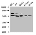 Western Blot
Positive WB detected in: Hela whole cell lysate, PC-3 whole cell lysate, HepG2 whole cell lysate, Mouse kidney tissue, Mouse brain tissue
All lanes: NR5A2 antibody at 3ug/ml
Secondary
Goat polyclonal to rabbit IgG at 1/50000 dilution
Predicted band size: 62, 57, 43, 54 kDa
Observed band size: 62, 54 kDa