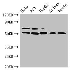 Western Blot
Positive WB detected in: Hela whole cell lysate, PC-3 whole cell lysate, HepG2 whole cell lysate, Mouse kidney tissue, Mouse brain tissue
All lanes: NR5A2 antibody at 3ug/ml
Secondary
Goat polyclonal to rabbit IgG at 1/50000 dilution
Predicted band size: 62, 57, 43, 54 kDa
Observed band size: 62, 54 kDa