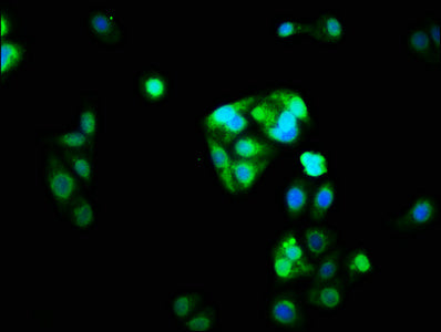 Immunofluorescence staining of HepG2 cells with CSB-PA016086LA01HU at 1:33, counter-stained with DAPI. The cells were fixed in 4% formaldehyde, permeabilized using 0.2% Triton X-100 and blocked in 10% normal Goat Serum. The cells were then incubated with the antibody overnight at 4°C. The secondary antibody was Alexa Fluor 488-congugated AffiniPure Goat Anti-Rabbit IgG(H+L).