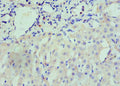 Immunohistochemistry of paraffin-embedded human liver tissue using CSB-PA016091ESR1HU at dilution of 1:100