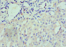 Immunohistochemistry of paraffin-embedded human liver tissue using CSB-PA016091ESR1HU at dilution of 1:100