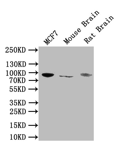 Western BlotPositive WB detected in: MCF7 whole cell lysate, Mouse Brain tissue lysate, Rat Brain tissue lysate All lanes: NTRK1 antibody at 1:1000SecondaryGoat polyclonal to rabbit IgG at 1/50000 dilutionPredicted band size: 88, 87, 84, 78 kDaObserved band size: 88 kDa