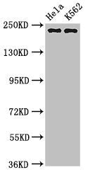 Western Blot
Positive WB detected in: Hela whole cell lysate, K562 whole cell lysate
All lanes: NUMA1 antibody at 3.2µg/ml
Secondary
Goat polyclonal to rabbit IgG at 1/50000 dilution
Predicted band size: 239, 237, 202, 201, 110 kDa
Observed band size: 239 kDa