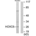 Western blot analysis of extracts from HUVEC cells, using HOXC6 antibody.