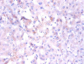 NDUFA1 Antibody, Biotin conjugated – Figure 1 of 2