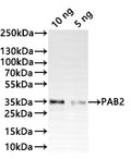 Western Blot
Positive WB detected in: recombinant protein
All lanes:PAB2 Antibody at 1:1000
Secondary
Goat polyclonal to rabbit IgG at 1/20000 dilution
Predicted band size: 35.5 kDa
Observed band size: 35 kDa