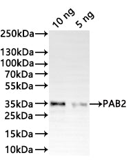 Western Blot
Positive WB detected in: recombinant protein
All lanes:PAB2 Antibody at 1:1000
Secondary
Goat polyclonal to rabbit IgG at 1/20000 dilution
Predicted band size: 35.5 kDa
Observed band size: 35 kDa