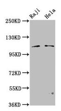 Western Blot
Positive WB detected in: Raji whole cell lysate, Hela whole cell lysate
All lanes: PACS1 antibody at 3.2µg/ml
Secondary
Goat polyclonal to rabbit IgG at 1/50000 dilution
Predicted band size: 105, 110 kDa
Observed band size: 110 kDa