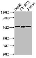 PRKN Antibody, Biotin conjugated – Figure 1 of 4