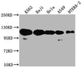Western Blot
Positive WB detected in: K562 whole cell lysate, Raji whole cell lysate, Hela whole cell lysate, A549 whole cell lysate, NTERA-2 whole cell lysate
All lanes: PARP1 antibody at 1:2000
Secondary
Goat polyclonal to rabbit IgG at 1/50000 dilution
Predicted band size: 114 kDa
Observed band size: 114 kDa