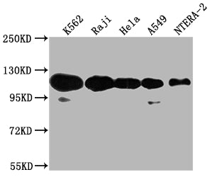 Western Blot
Positive WB detected in: K562 whole cell lysate, Raji whole cell lysate, Hela whole cell lysate, A549 whole cell lysate, NTERA-2 whole cell lysate
All lanes: PARP1 antibody at 1:2000
Secondary
Goat polyclonal to rabbit IgG at 1/50000 dilution
Predicted band size: 114 kDa
Observed band size: 114 kDa