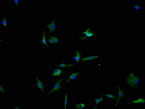 Immunofluorescence staining of U251 cells with CSB-PA017530LA01HU-IF at 1:100, counter-stained with DAPI. The cells were fixed in 4% formaldehyde and blocked in 10% normal Goat Serum. The cells were then incubated with the antibody overnight at 4°C. The secondary antibody was Alexa Fluor 488-congugated AffiniPure Goat Anti-Rabbit IgG(H+L).