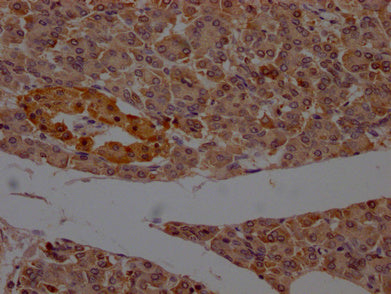 IHC image of CSB-PA017627LA11HU diluted at 1:200 and staining in paraffin-embedded human pancreatic tissue performed on a Leica BondTM system. After dewaxing and hydration, antigen retrieval was mediated by high pressure in a citrate buffer (pH 6.0). Section was blocked with 10% normal goat serum 30min at RT. Then primary antibody (1% BSA) was incubated at 4°C overnight. The primary is detected by a Goat anti-rabbit polymer IgG labeled by HRP and visualized using 0.05% DAB.