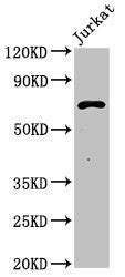 Western Blot
Positive WB detected in: Jurkat whole cell lysate
All lanes: Pcsk1 antibody at 3ug/ml
Secondary
Goat polyclonal to rabbit IgG at 1/50000 dilution
Predicted band size: 71 kDa
Observed band size: 71 kDa