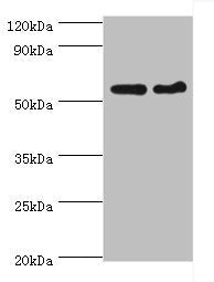 Western blot All lanes: CDK16 antibody at 5ug/ml Lane 1: Mouse brain tissue Lane 2: Mouse small intestine tissue Secondary Goat polyclonal to rabbit IgG at 1/10000 dilution Predicted band size: 56, 64, 57 kDa Observed band size: 56 kDa