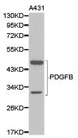 Western blot analysis of extracts of A431 cell lines  using PDGFB antibody.