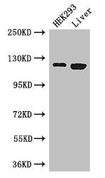 Western Blot
Positive WB detected in: HEK293 whole cell lysate, Mouse liver tissue
All lanes: PDGFRA antibody at 3ug/ml
Secondary
Goat polyclonal to rabbit IgG at 1/50000 dilution
Predicted band size: 123, 25, 83 kDa
Observed band size: 123 kDa