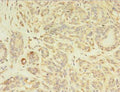 PDGFRB Antibody, HRP conjugated – Figure 1 of 2