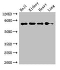 Western Blot
Positive WB detected in: Raji whole cell lysate, Mouse kidney tissue, Rat heart tissue, Rat lung tissue
All lanes: PECAM1 antibody at 2.7ug/ml
Secondary
Goat polyclonal to rabbit IgG at 1/50000 dilution
Predicted band size: 83, 81, 80, 82 kDa
Observed band size: 83 kDa