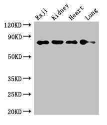 Western Blot
Positive WB detected in: Raji whole cell lysate, Mouse kidney tissue, Rat heart tissue, Rat lung tissue
All lanes: PECAM1 antibody at 2.7ug/ml
Secondary
Goat polyclonal to rabbit IgG at 1/50000 dilution
Predicted band size: 83, 81, 80, 82 kDa
Observed band size: 83 kDa