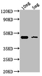 Western Blot
Positive WB detected in Recombinant protein
All lanes: GPM1 antibody at 1:2000
Secondary
Goat polyclonal to rabbit IgG at 1/50000 dilution
Predicted band size: 42.8 kDa
Observed band size: 44 kDa