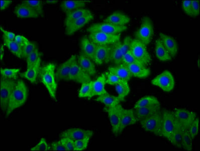Immunofluorescence staining of HepG2 cells with CSB-PA017896LA01HU at 1:133, counter-stained with DAPI. The cells were fixed in 4% formaldehyde, permeabilized using 0.2% Triton X-100 and blocked in 10% normal Goat Serum. The cells were then incubated with the antibody overnight at 4&deg;C. The secondary antibody was Alexa Fluor 488-congugated AffiniPure Goat Anti-Rabbit IgG(H+L).