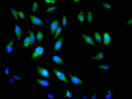 Immunofluorescent analysis of Hela cells using CSB-PA017999LA01HU at dilution of 1:100 and Alexa Fluor 488-congugated AffiniPure Goat Anti-Rabbit IgG(H+L)