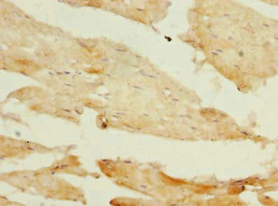Immunohistochemistry of paraffin-embedded human skeletal muscle tissue using CSB-PA018003LA01HU at dilution of 1:100