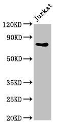 Western Blot
Positive WB detected in: Jurkat whole cell lysate
All lanes: PIK3R2 antibody at 4ug/ml
Secondary
Goat polyclonal to rabbit IgG at 1/50000 dilution
Predicted band size: 82 kDa
Observed band size: 82 kDa