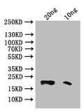 Western Blot
Positive WB detected in: recombinant protein
All lanes: Phospholipase A2 Antibody at 1:1000
Secondary
Goat polyclonal to rabbit IgG at 1/50000 dilution
Predicted band size: 20 kDa
Observed band size: 20 kDa