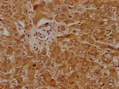 IHC image of CSB-PA018188LA01HU diluted at 1:1000 and staining in paraffin-embedded human liver tissue performed on a Leica BondTM system. After dewaxing and hydration, antigen retrieval was mediated by high pressure in a citrate buffer (pH 6.0). Section was blocked with 10% normal goat serum 30min at RT. Then primary antibody (1% BSA) was incubated at 4°C overnight. The primary is detected by a biotinylated secondary antibody and visualized using an HRP conjugated SP system.