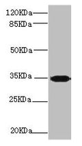 Western blot All lanes: PLSCR1 antibody at 2.24µg/ml + 293T whole cell lysate Secondary Goat polyclonal to rabbit IgG at 1/10000 dilution Predicted band size: 36, 27 kDa Observed band size: 36 kDa