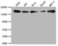 Western Blot
Positive WB detected in: A549 whole cell lysate, 293 whole cell lysate, Hela whole cell lysate, HepG2 whole cell lysate, MCF-7 whole cell lysate
All lanes: PLXNB2 antibody at 1:1000
Secondary
Goat polyclonal to rabbit IgG at 1/50000 dilution
Predicted band size: 206 kDa
Observed band size: 206 kDa