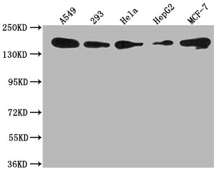 Western Blot
Positive WB detected in: A549 whole cell lysate, 293 whole cell lysate, Hela whole cell lysate, HepG2 whole cell lysate, MCF-7 whole cell lysate
All lanes: PLXNB2 antibody at 1:1000
Secondary
Goat polyclonal to rabbit IgG at 1/50000 dilution
Predicted band size: 206 kDa
Observed band size: 206 kDa