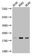 Western Blot
Positive WB detected in: A549 whole cell lysate, K562 whole cell lysate, HL60 whole cell lysate
All lanes: POLR2G antibody at 1:2000
Secondary
Goat polyclonal to rabbit IgG at 1/50000 dilution
Predicted band size: 20 kDa
Observed band size: 20 kDa
