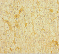 Immunohistochemistry of paraffin-embedded human adrenal gland tissue using CSB-PA018363NJ01HU at dilution of 1:100