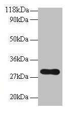 Western blot
All lanes: POMC antibody at 2µg/ml + NIH/3T3 whole cell lysate
Secondary
Goat polyclonal to rabbit IgG at 1/10000 dilution
Predicted band size: 30 kDa
Observed band size: 30 kDa