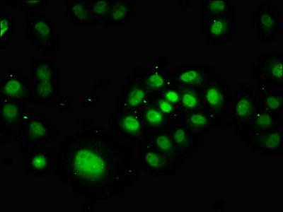 Immunofluorescence staining of Hela cells with CSB-PA018393LA01HU at 1:166, counter-stained with DAPI. The cells were fixed in 4% formaldehyde, permeabilized using 0.2% Triton X-100 and blocked in 10% normal Goat Serum. The cells were then incubated with the antibody overnight at 4&deg;C. The secondary antibody was Alexa Fluor 488-congugated AffiniPure Goat Anti-Rabbit IgG(H+L).