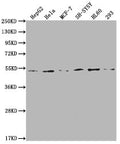 Western Blot
Positive WB detected in: HepG2 whole cell lysate, Hela whole cell lysate, MCF-7 whole cell lysate, SH-SY5Y whole cell lysate, HL60 whole cell lysate, 293 whole cell lysate
All lanes: PPARA antibody at 1:2000
Secondary
Goat polyclonal to rabbit IgG at 1/50000 dilution
Predicted band size: 53, 19 kDa
Observed band size: 53 kDa