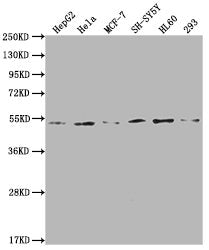 Western Blot
Positive WB detected in: HepG2 whole cell lysate, Hela whole cell lysate, MCF-7 whole cell lysate, SH-SY5Y whole cell lysate, HL60 whole cell lysate, 293 whole cell lysate
All lanes: PPARA antibody at 1:2000
Secondary
Goat polyclonal to rabbit IgG at 1/50000 dilution
Predicted band size: 53, 19 kDa
Observed band size: 53 kDa