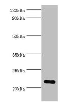 Western blot
All lanes: Peroxiredoxin-1 antibody at 2ug/ml + Hela whole cell lysate
Secondary
Goat polyclonal to rabbit IgG at 1/10000 dilution
Predicted band size: 22 kDa
Observed band size: 22 kDa