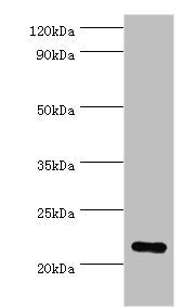 Western blot
All lanes: Peroxiredoxin-1 antibody at 2ug/ml + Hela whole cell lysate
Secondary
Goat polyclonal to rabbit IgG at 1/10000 dilution
Predicted band size: 22 kDa
Observed band size: 22 kDa