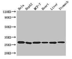 Western Blot
Positive WB detected in: Hela whole cell lysate, HepG2 whole cell lysate, MCF-7 whole cell lysate, Mouse heart tissue, Mouse liver tissue, Mouse stomach tissue
All lanes: PRDX3 antibody at 3.2µg/ml
Secondary
Goat polyclonal to rabbit IgG at 1/50000 dilution
Predicted band size: 28, 26 kDa
Observed band size: 28 kDa