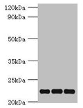 Western blot All lanes: PRDX5 antibody at 4µg/ml Lane 1: Mouse brain tissue Lane 2: Hela whole cell lysate Lane 3: 293T whole cell lysate Secondary Goat polyclonal to rabbit IgG at 1/10000 dilution Predicted band size: 23, 18, 13 kDa Observed band size: 23 kDa