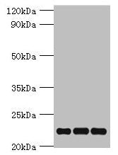 Western blot All lanes: PRDX5 antibody at 4µg/ml Lane 1: Mouse brain tissue Lane 2: Hela whole cell lysate Lane 3: 293T whole cell lysate Secondary Goat polyclonal to rabbit IgG at 1/10000 dilution Predicted band size: 23, 18, 13 kDa Observed band size: 23 kDa