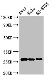 Western Blot
Positive WB detected in: A549 whole cell lysate, Hela whole cell lysate, SH-SY5Y whole cell lysate
All lanes: PRDX6 antibody at 4ug/ml
Secondary
Goat polyclonal to rabbit IgG at 1/50000 dilution
Predicted band size: 26 kDa
Observed band size: 26 kDa