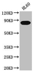 Western Blot
Positive WB detected in: HL60 whole cell lysate
All lanes: PREP antibody at 1:2000
Secondary
Goat polyclonal to rabbit IgG at 1/50000 dilution
Predicted band size: 81 kDa
Observed band size: 81 kDa