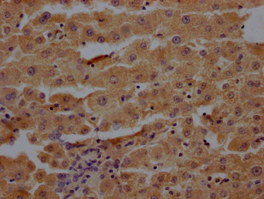 IHC image of CSB-PA018672LA01HU diluted at 1:200 and staining in paraffin-embedded human liver tissue performed on a Leica BondTM system. After dewaxing and hydration, antigen retrieval was mediated by high pressure in a citrate buffer (pH 6.0). Section was blocked with 10% normal goat serum 30min at RT. Then primary antibody (1% BSA) was incubated at 4°C overnight. The primary is detected by a Goat anti-rabbit polymer IgG labeled by HRP and visualized using 0.05% DAB.